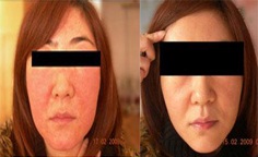 天津皮膚病醫院