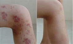 天津皮膚病醫院